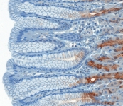 Atlas Antibodies Standard-Protokoll für die Immunhistochemie (IHC)